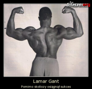 Fig 2 - Lamar Gant, despite his scoliosis he was the first man to deadlift 5 times his body weight.